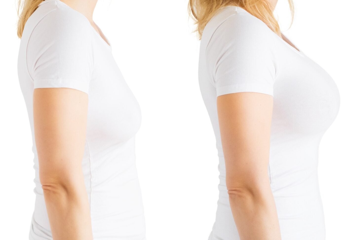 سعر كريم بيلا لتكبير الثدي في مصر